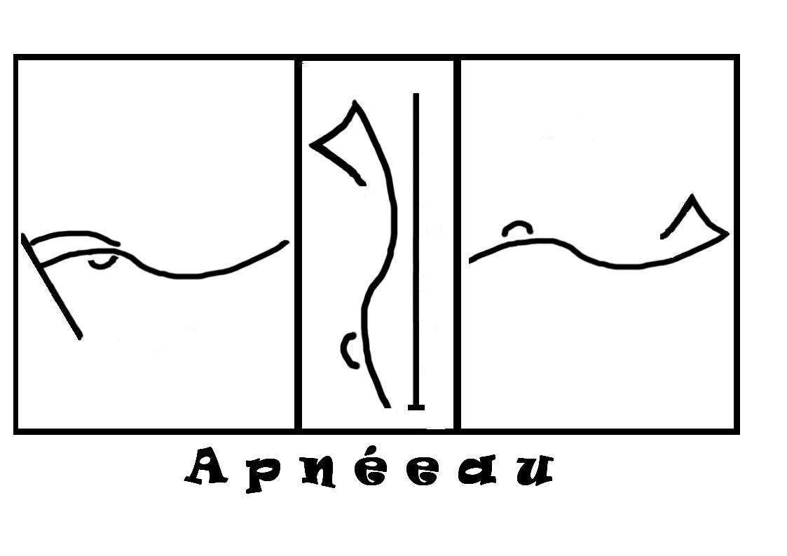 APNEEAU Forum Index